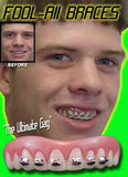 BILLY BOB FAKE TEETH WITH BRACES ( sold by the piece )
