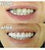 ORIGINAL FLEXIBLE ULTRA THIN INSTANT SMILE PERFECT TEETH (sold by the piece )